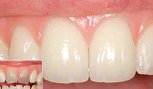 sthetische Zahnheilkunde