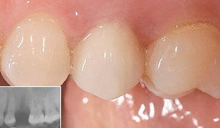 Ästhetische Zahnheilkunde